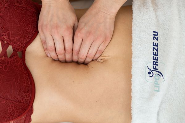 diastasis recti treatment Greenock