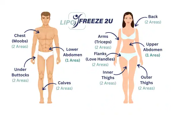 Areas you can have fat freezing treatment Greenock