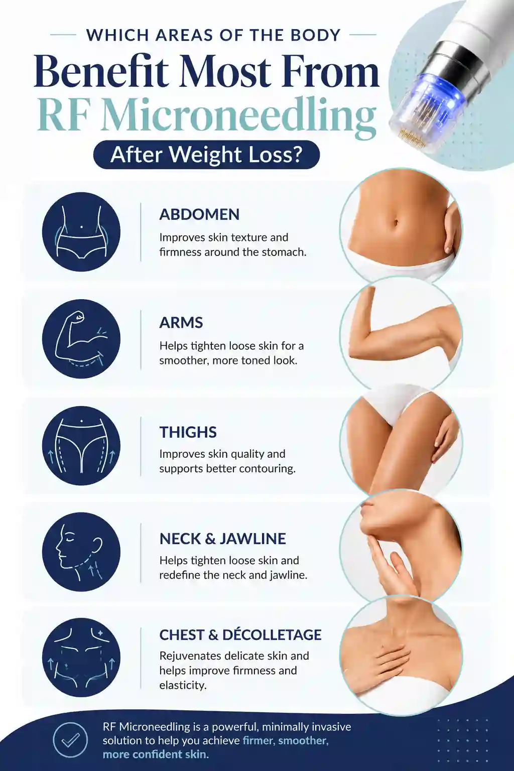 Which Areas of the Body Benefit Most From RF Microneedling After Weight Loss Greenock